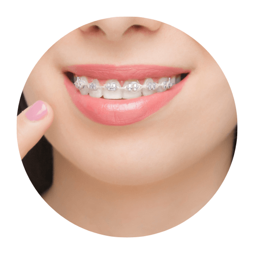 clinica dental las rozas ortodoncia de brackets